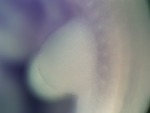 EMAGE:26584