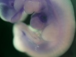 EMAGE:26647
