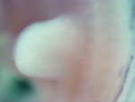 EMAGE:26647