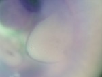EMAGE:26647