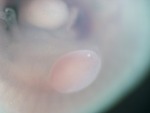 EMAGE:26648