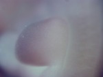 EMAGE:26698