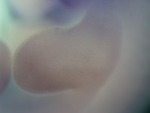 EMAGE:26715