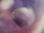 EMAGE:26760