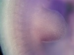 EMAGE:26767