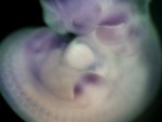 EMAGE:26775