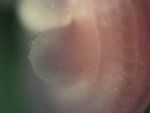 EMAGE:26803