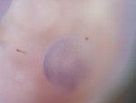 EMAGE:26805