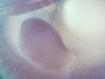 EMAGE:26825