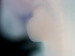 EMAGE:26835