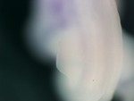 EMAGE:26851