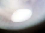 EMAGE:26882
