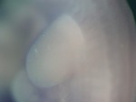 EMAGE:26885