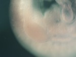EMAGE:26932