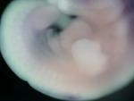 EMAGE:26952