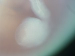 EMAGE:26953