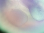 EMAGE:26976