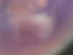 EMAGE:26998