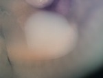 EMAGE:27022
