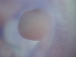 EMAGE:27034