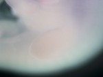 EMAGE:27035