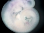 EMAGE:27038