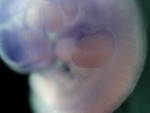 EMAGE:27045
