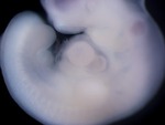 EMAGE:27054