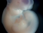 EMAGE:27061