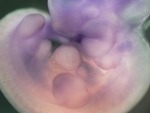 EMAGE:27069