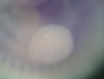 EMAGE:27074