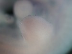 EMAGE:27091