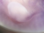 EMAGE:27101