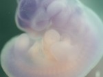 EMAGE:27117