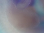 EMAGE:27146