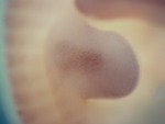 EMAGE:27194