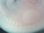 EMAGE:27224