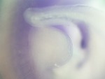EMAGE:27243