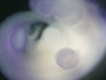 EMAGE:27277