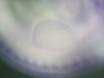 EMAGE:27278