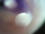EMAGE:27366