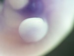 EMAGE:27378