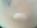 EMAGE:27424
