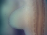 EMAGE:27435