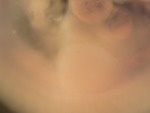 EMAGE:27440