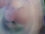 EMAGE:27462