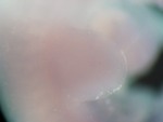 EMAGE:27463
