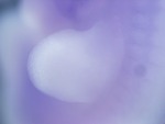 EMAGE:27478