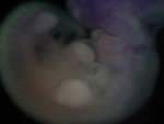 EMAGE:27484