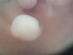 EMAGE:27560